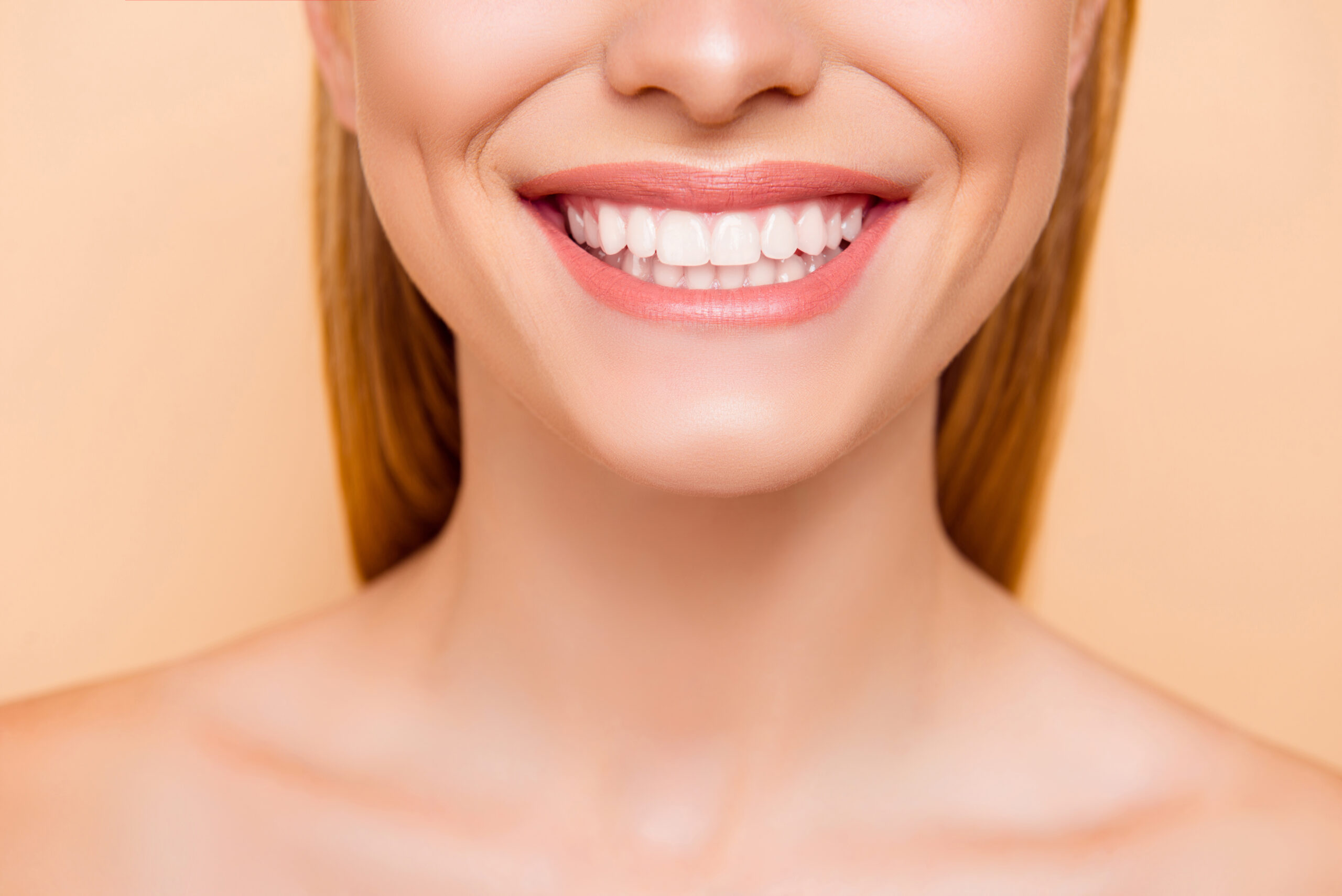 Teeth Whitening in Marble Hill, GA: Get a Brighter Smile Fast