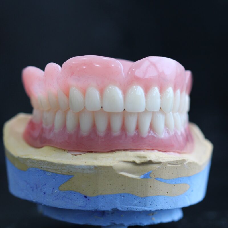 Full Arch Dental Implants In marble hill