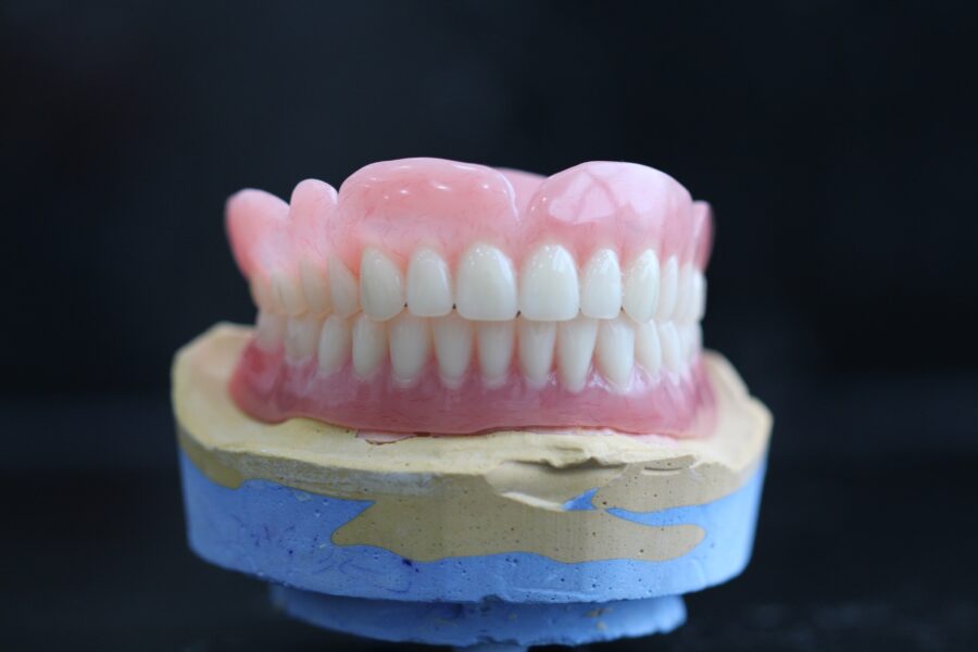 Full Arch Dental Implants In marble hill
